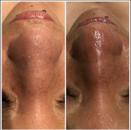 Gallery photo 1 of Mobile Facial Service