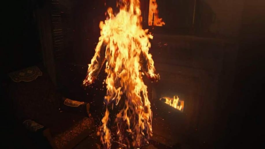 Gallery photo 7 of Ohio Burn Unit