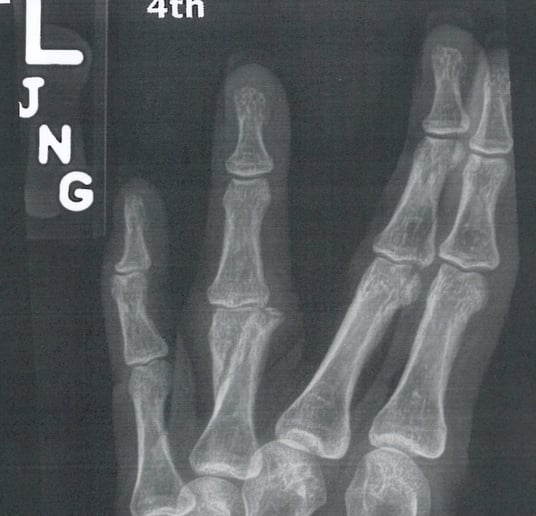Gallery photo 3 of Realities of Domestic Abuse