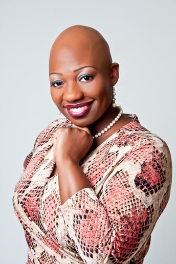 Gallery photo 2 of Sandra Dubose, The Bald Beauty Queen of SelfEsteem
