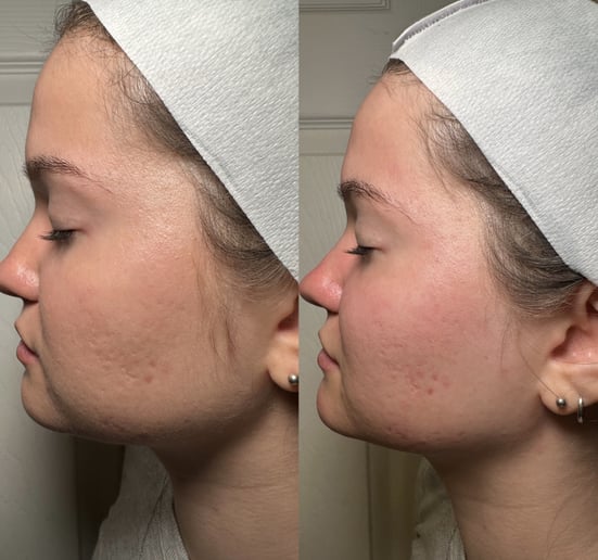 Gallery photo 6 of Skincare with Purpose, Beauty with Grace