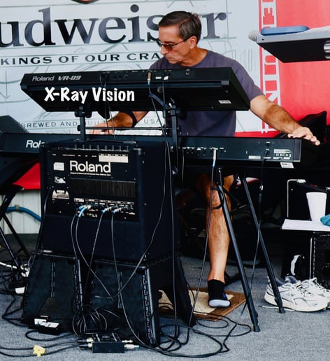 Gallery photo 7 of X-ray Vision Band